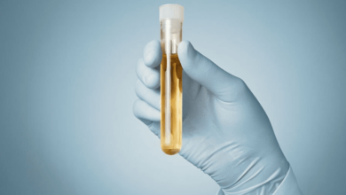 revolutionizing-drug-screening:-unveiling-12-panel-now’s-18-panel-urine-test