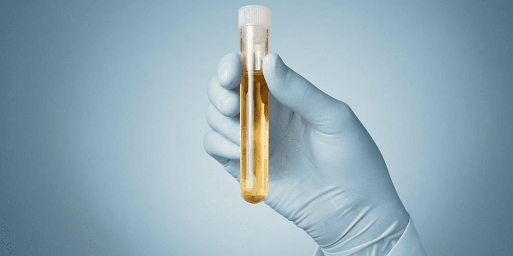 revolutionizing-drug-screening:-unveiling-12-panel-now’s-18-panel-urine-test